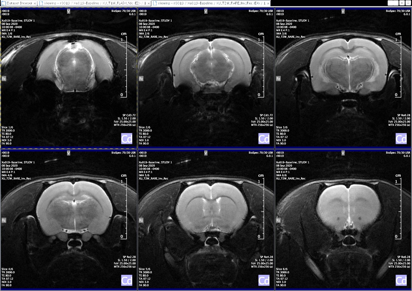 Oxygen deficiency monitors for MRI room- Magnetic Resonance Imaging