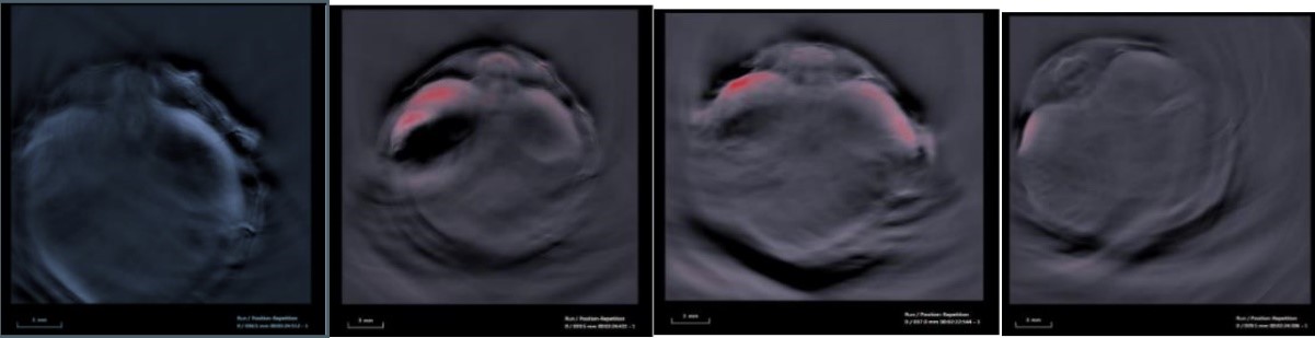 services-page-photoacoustic